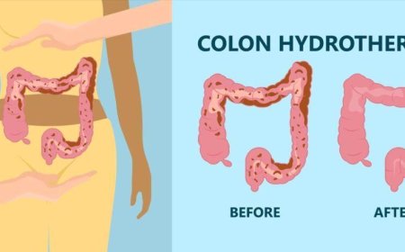 What to Know About Colon Detox in Croydon: Benefits, Process & Care