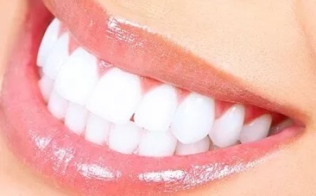 Can Smokers Benefit from Laser Teeth Whitening?