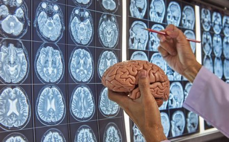 Neurologist vs. Neurosurgeon: Who Should You See in Bharuch and When?