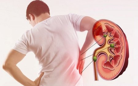 Advanced Kidney Stone Treatment in Jaipur by Expert Urologists