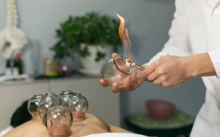 Discover the Healing Power of Dry Cupping Therapy at Dynasty Clinic