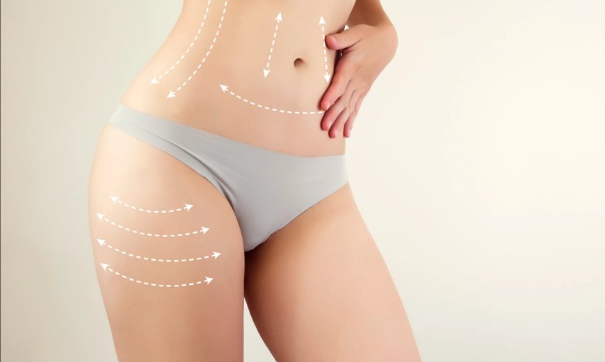 Your Pre-Lipo Guide What Best Liposuction Surgeons in Dubai Recommend