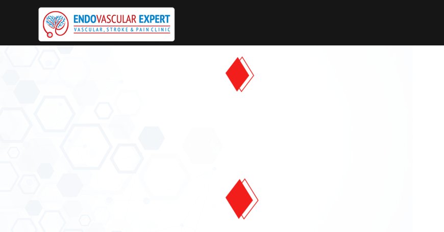 Uterine Fibroid Embolization (UFE): A Non-Surgical Alternative to Hysterectomy in Jaipur