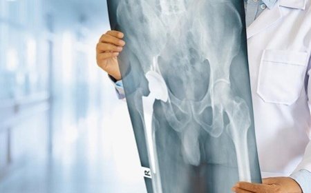 From Crutches to Comeback: Real Stories from Nagpur’s Top Orthopedic Ward