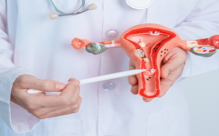 Uterine Fibroids: What Every Woman Should Know