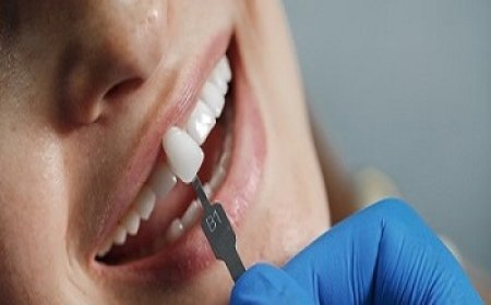 Affordable Dental Care: Finding Bulk Billing Dentists on the Gold Coast