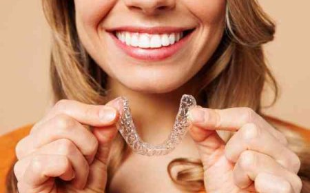 How Invisalign Corrects Overbite Without Changing the Jaw
