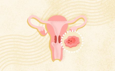 Cervical Cancer: Causes, Symptoms, Diagnosis & Treatment