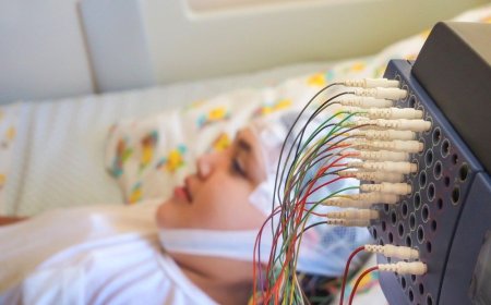 EEG Test Price – Understanding Cost, Importance & Booking Options