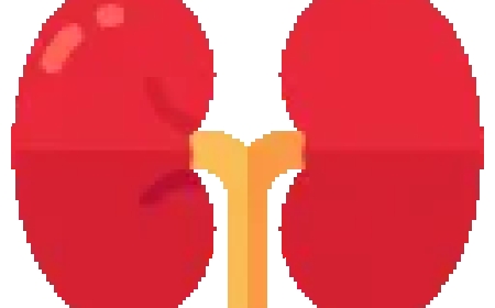 Kidney Transplant in Turkey: Costs, Hospitals, and What International Patients Should Know