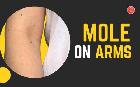 Mole on Arms: Meanings, Health Risks & Spiritual Insights