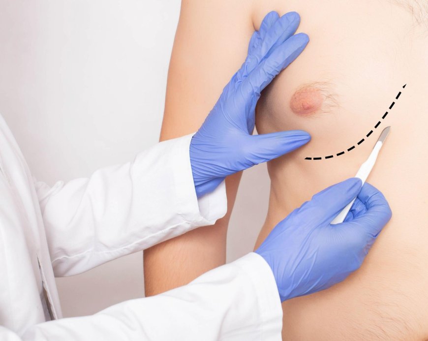 What You Should Know About Anesthesia in Gynecomastia Surgery