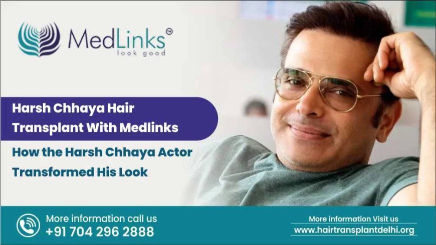 Harsh Chhaya Hair Transplant With MedLinks: A Subtle Yet Striking Transformation