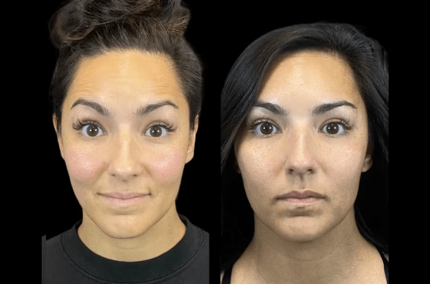 How to Identify the Best Aesthetic Clinic in Dubai: What to Look For