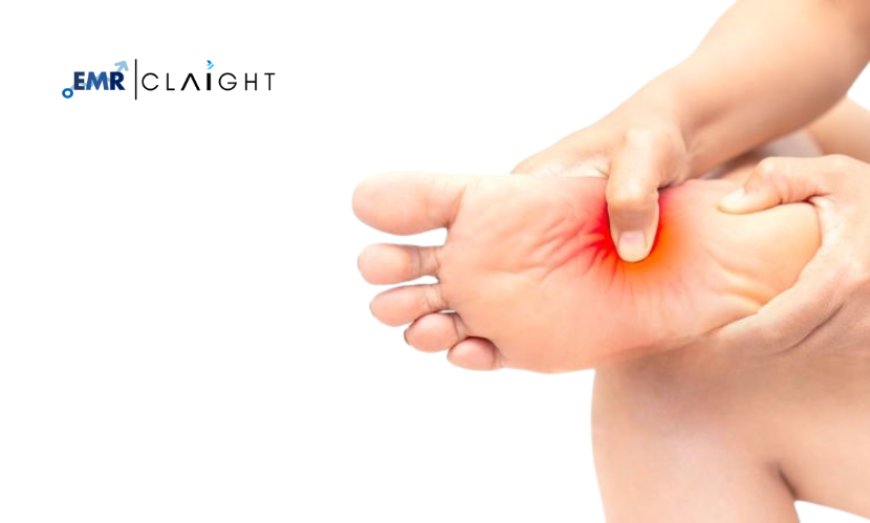 Peripheral Neuropathy Treatment Market Outlook | 2034