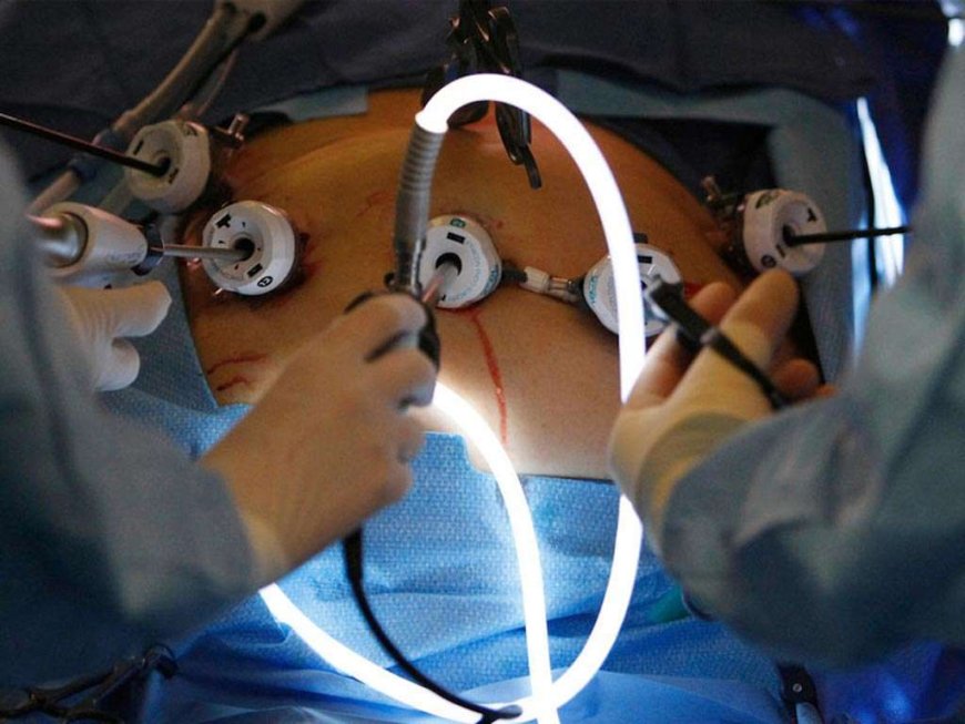 Complications & Recovery After Weight Loss Surgery